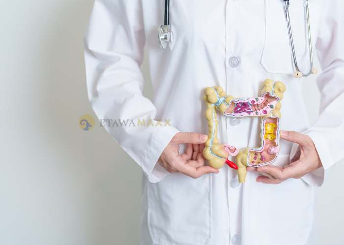 Peran Susu Kambing Etawa Dalam Meningkatkan Kesehatan Pencernaan